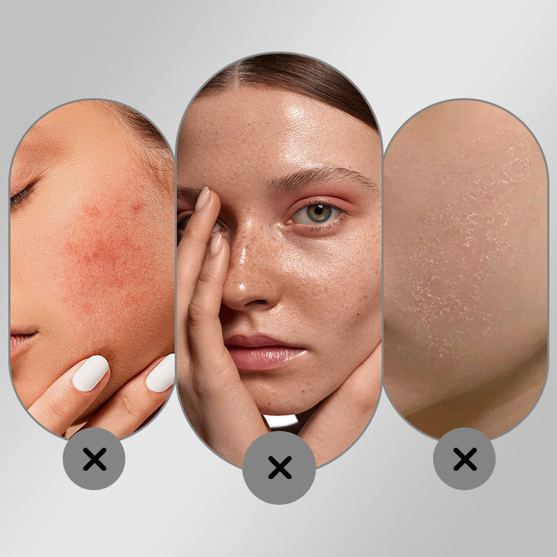 🔥🖤🎉Black Friday Specials 50% OFF🎁🎉Whitening Hydrating Freckle Removing Face Cream
