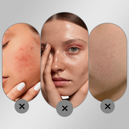 🔥🖤🎉Black Friday Specials 50% OFF🎁🎉Whitening Hydrating Freckle Removing Face Cream